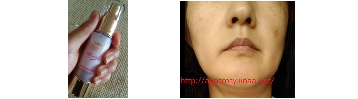 ロージーを使用した写真